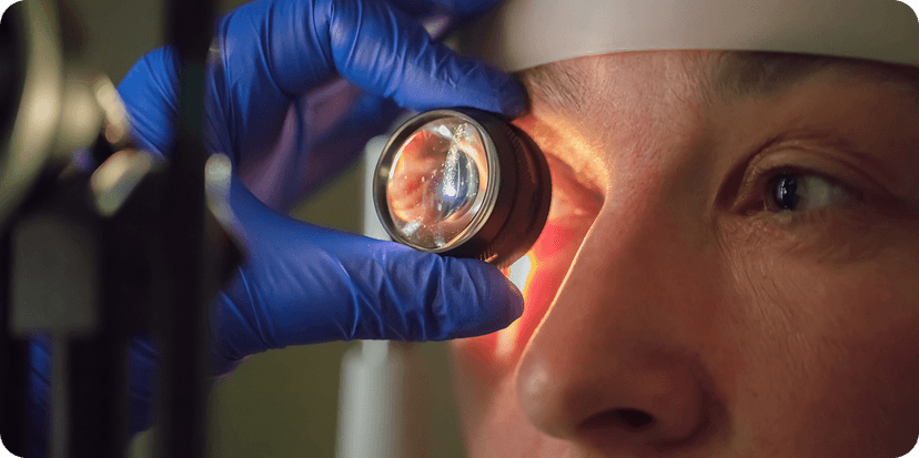 Keratoconus eye examination