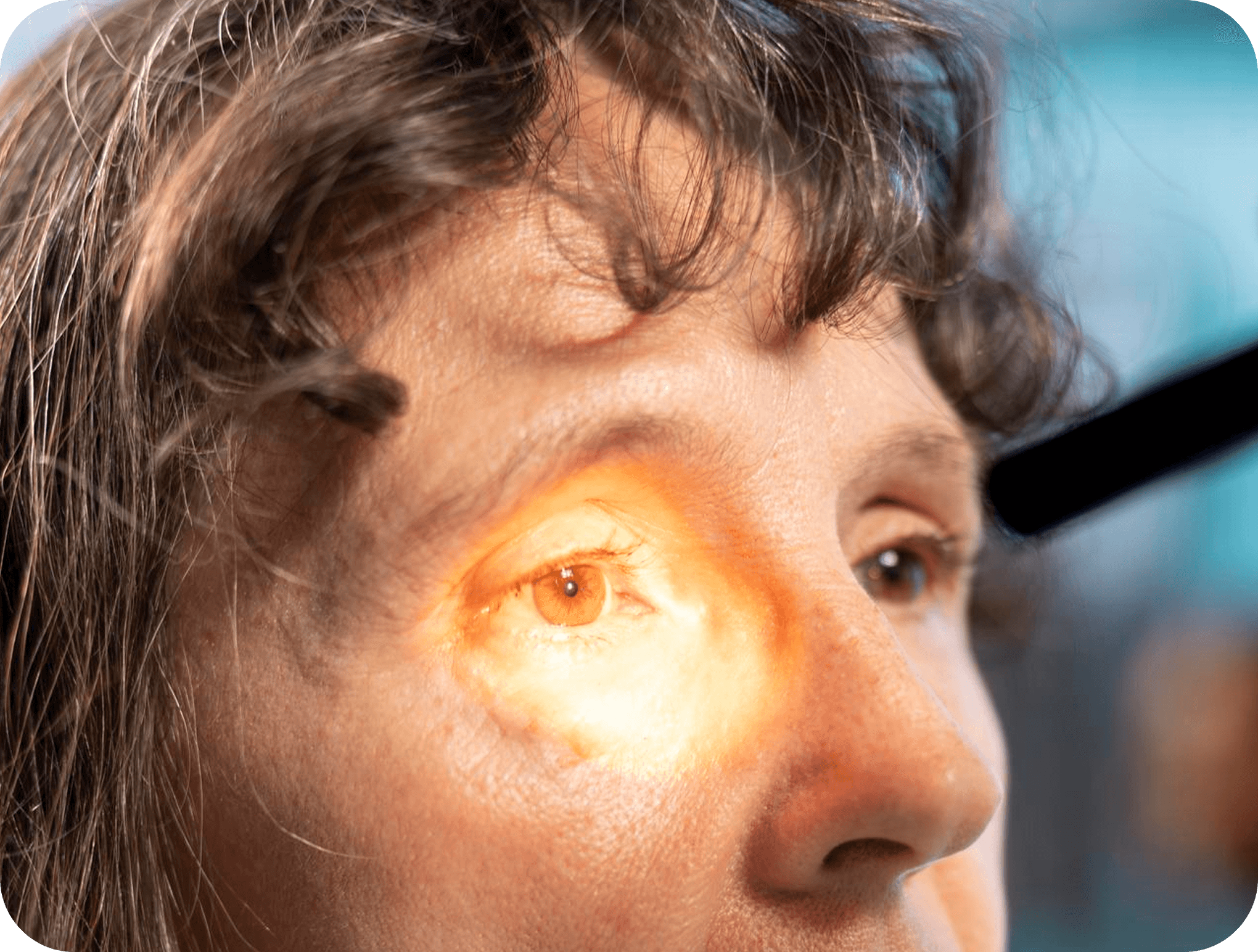 Retina eye examination