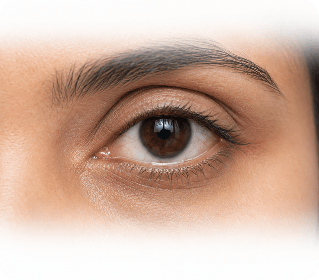 Mixed Dry Eye