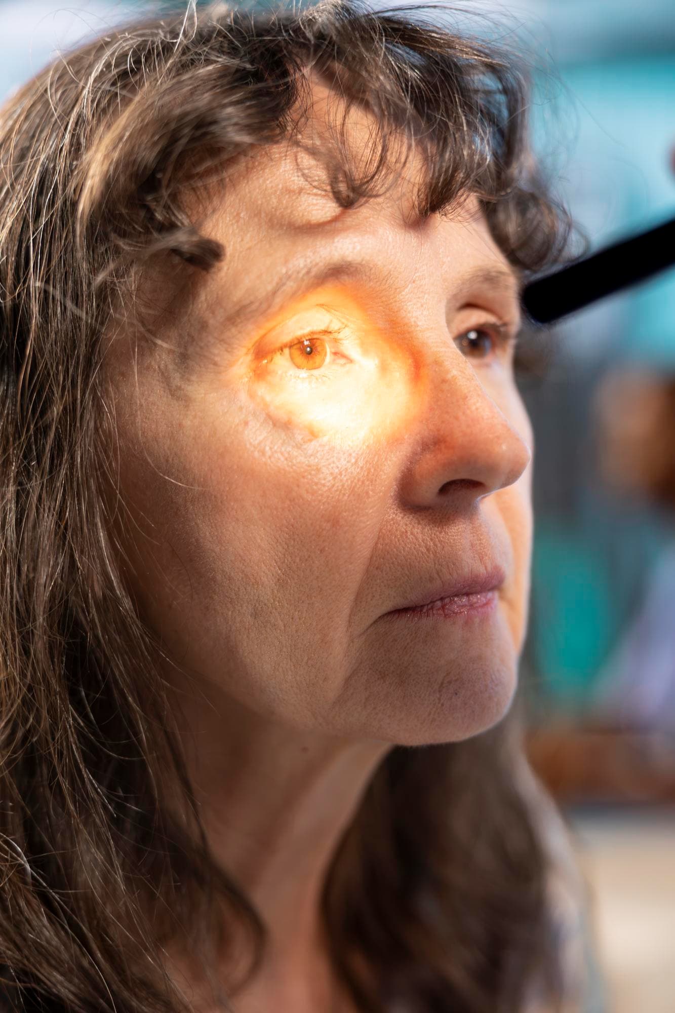 Glaucoma symptoms