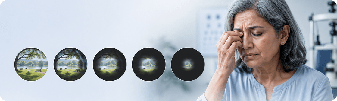 Types of Glaucoma