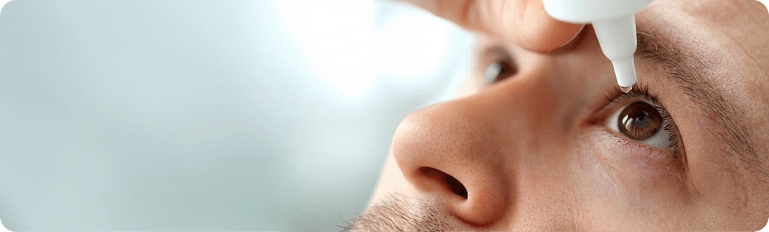 Keratoconus diagnosis evaluation